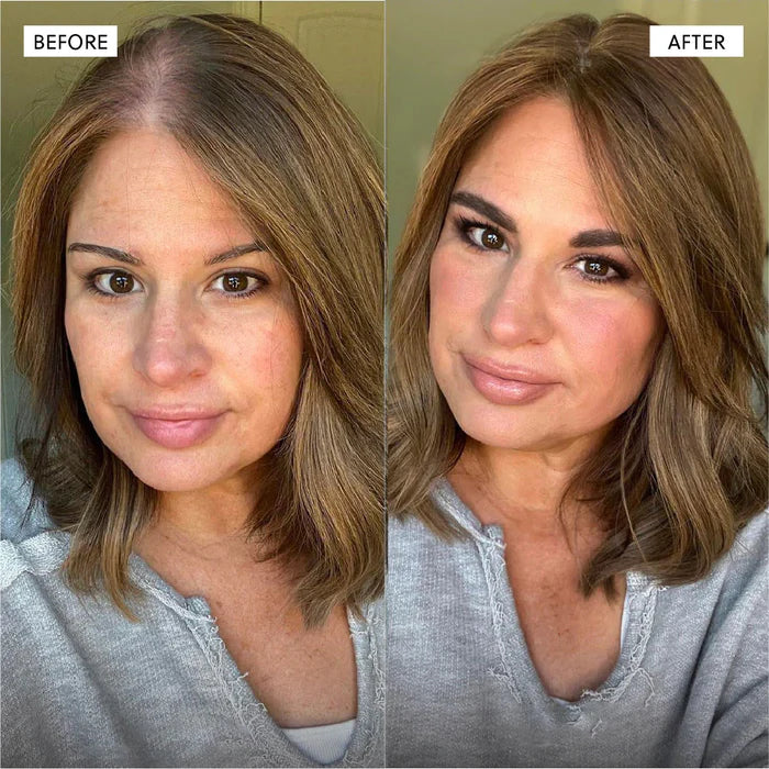 The Kiora Club Hair Growth Spray