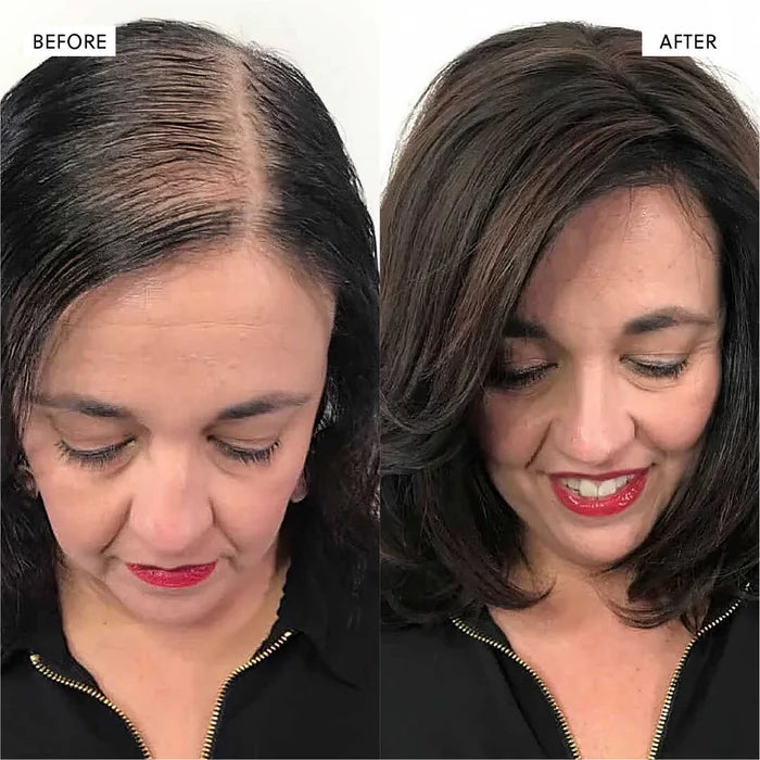 The Kiora Club Hair Growth Spray