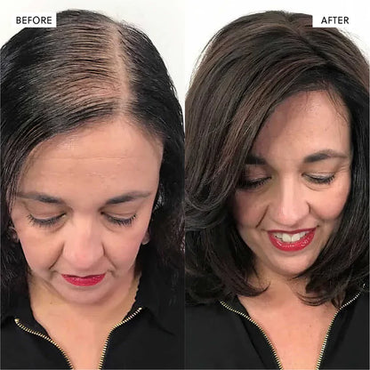 The Kiora Club Hair Growth Spray