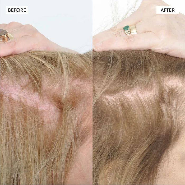 The Kiora Club Hair Growth Spray