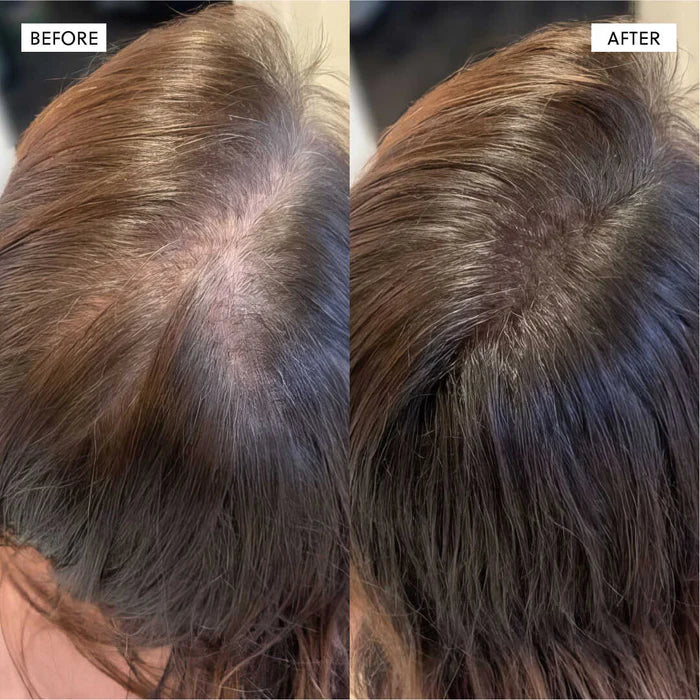 The Kiora Club Hair Growth Spray