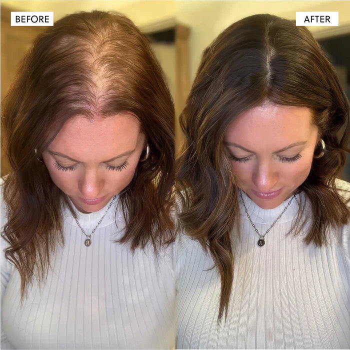 The Kiora Club Hair Growth Spray